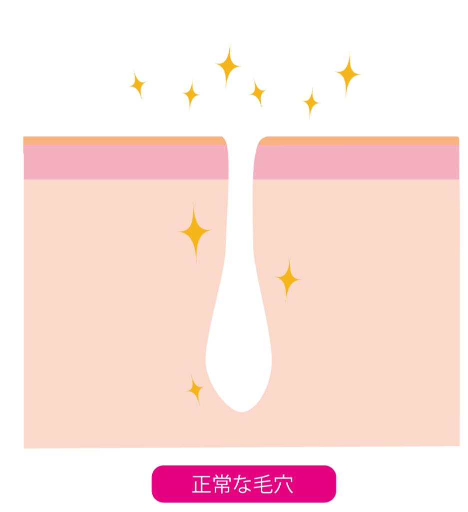 イオン導出　きれいな毛穴